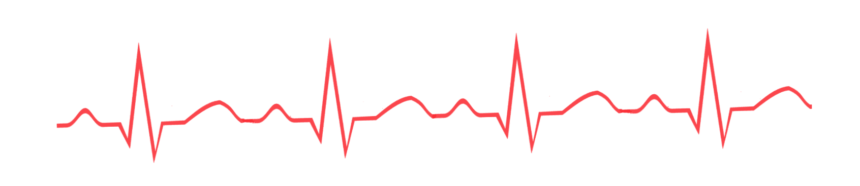 ECG Curve