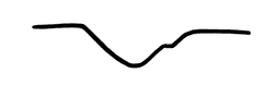 ECG curve