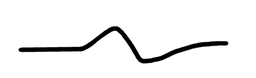 ECG curve