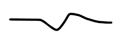 ECG curve